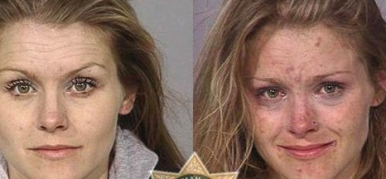 絕對不要吸毒！吸毒前吸毒後照片