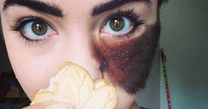 美女臉上毛胎記